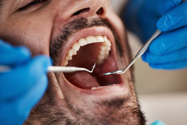 Best Emergency Tooth Extraction in Payson, IL